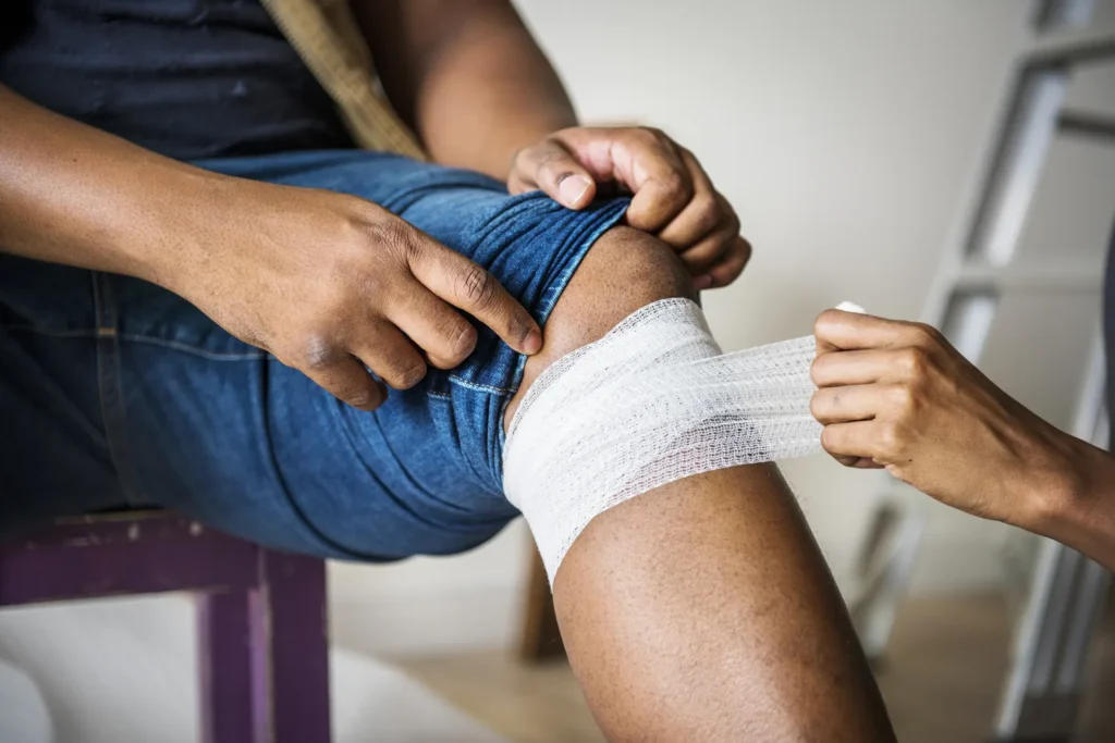 Profissional de saude realizando curativo com atadura no joelho de paciente para tratamento de feridas com exsudato