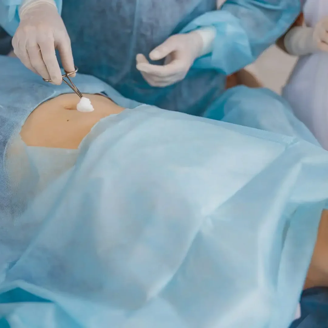 Profissional de saúde realizando antissepsia da pele de paciente com gaze antes de procedimento cirúrgico