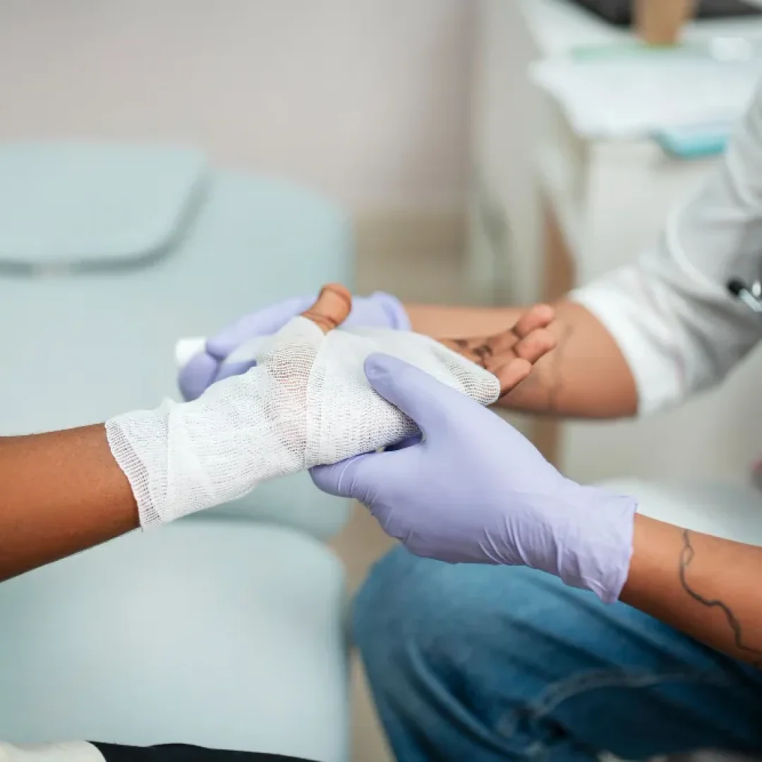 Profissional de saude com luvas realizando curativo na mao de paciente para tratamento de biofilme na ferida em consultorio