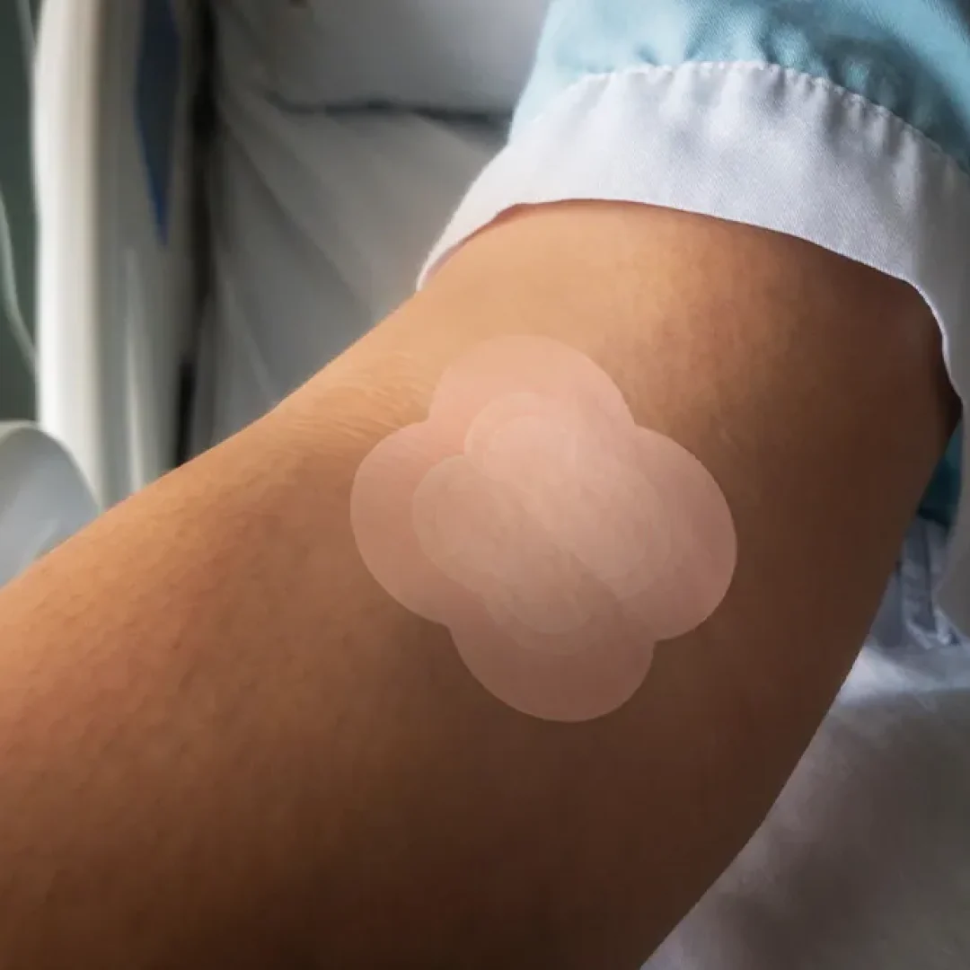 Curativo de espuma com prata aplicado no braço de paciente deitado, mostrando cobertura discreta e proteção da área após procedimento.