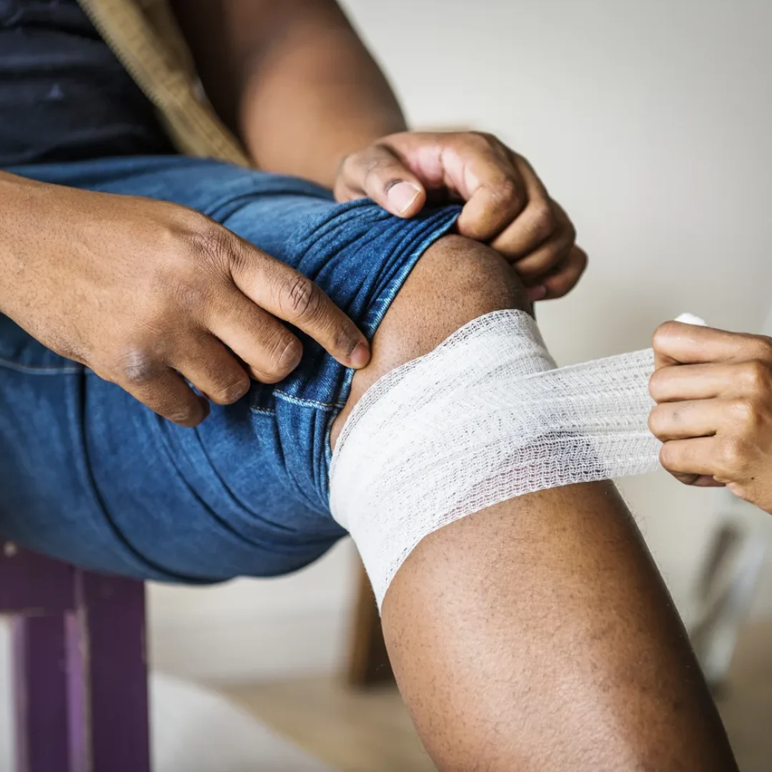 Profissional de saude realizando curativo com atadura no joelho de paciente para tratamento de feridas com exsudato